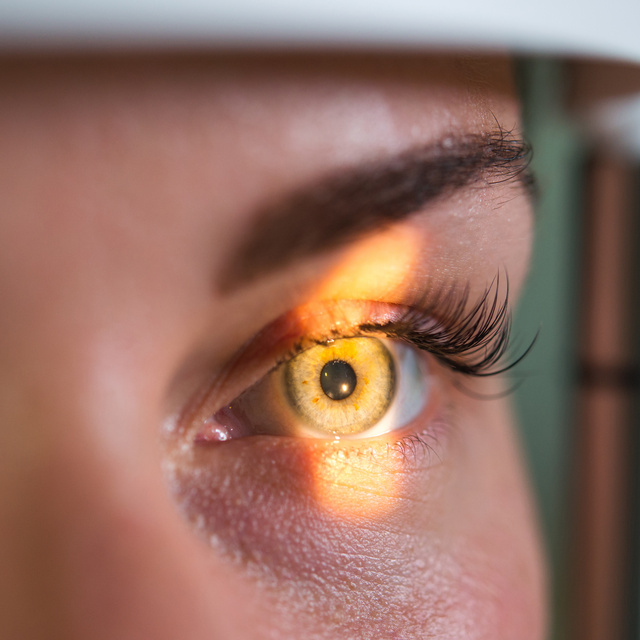 Vision Therapy in West Plano